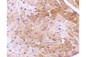 Immunohistochemistry of CIDE-A in mouse heart tissue with CIDE-A antibody at 5 μg/ml. (CIDEA anticorps  (C-Term))
