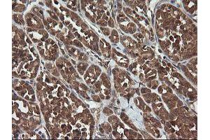 Image no. 8 for anti-Trafficking Protein Particle Complex 4 (TRAPPC4) antibody (ABIN1501265)