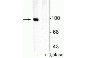 Western blot of rat hippocampal lysate showing specific immunolabeling of the ~100 kDa GluR1 protein phosphorylated at Ser831 in the first lane (-). (Glutamate Receptor 1 anticorps  (pSer831))