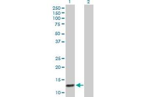Western Blot analysis of ABCC6 expression in transfected 293T cell line by ABCC6 MaxPab polyclonal antibody.