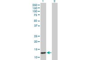 Western Blot analysis of ABCC6 expression in transfected 293T cell line by ABCC6 MaxPab polyclonal antibody. (ABCC6 anticorps  (AA 1-99))