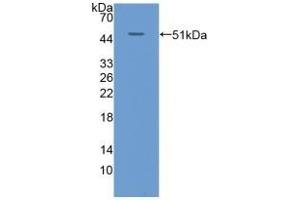 Detection of Recombinant KRT20, Human using Polyclonal Antibody to Cytokeratin 20 (CK 20) (KRT20 anticorps  (AA 9-424))