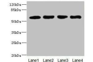 Western blot All lanes: IL21R antibody at 2. (IL21 Receptor anticorps  (AA 20-240))
