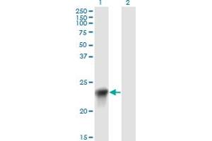 Western Blot analysis of BLVRB expression in transfected 293T cell line by BLVRB monoclonal antibody (M09), clone 2F4.