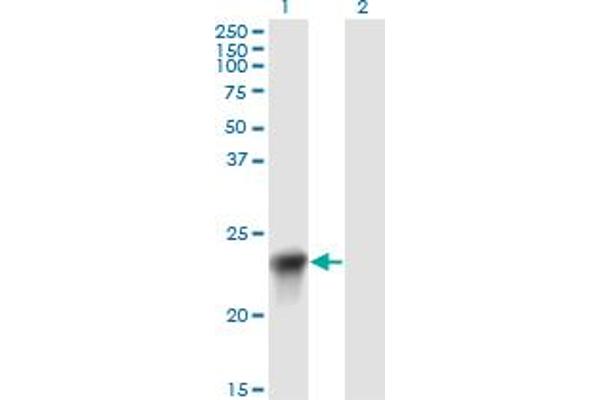 BLVRB anticorps  (AA 107-206)