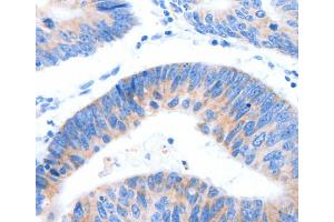 Immunohistochemistry (IHC) image for anti-Mucin 3A, Cell Surface Associated (MUC3A) antibody (ABIN2426702) (MUC3A anticorps)
