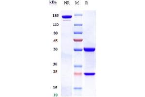Anti-B7-H4 / VTCN1 Reference Antibody (alsevalimab) on SDS-PAGE under reducing (R) condition. (Recombinant B7-H4 (Alsevalimab Biosimilar) anticorps)