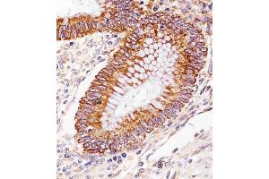 Immunohistochemical analysis of paraffin-embedded H. (ICT1 anticorps  (C-Term))