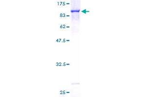 Image no. 1 for Optineurin (OPTN) (AA 1-577) protein (GST tag) (ABIN1313422)
