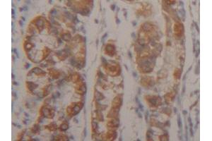 IHC-P analysis of Human Stomach Tissue, with DAB staining. (Cytokeratin 18 anticorps  (AA 238-396))