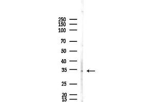 Western blot analysis of lysates from F10-LUC cells(starvation,24h treatment), using Olfactory receptor 2 Antibody at 1/1000 dilution.