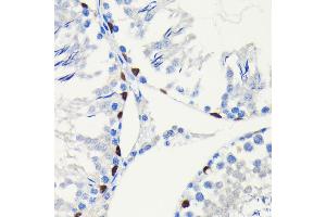 Immunohistochemistry of paraffin-embedded rat testis using SOX9 antibody (ABIN7270577) at dilution of 1:100 (40x lens).