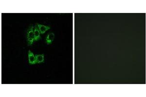 Immunofluorescence analysis of A549 cells, using GIMAP2 antibody. (GIMAP2 anticorps  (Internal Region))