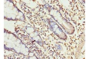 Immunohistochemistry of paraffin-embedded human small intestine tissue using ABIN7174649 at dilution of 1:100 (UGT3A2 anticorps  (AA 23-300))