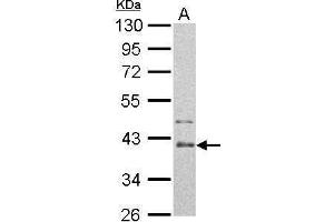 WB Image Arginase II antibody detects ARG2 protein by Western blot analysis.