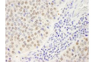 Immunohistochemistry (IHC) image for anti-Symplekin (SYMPK) (AA 1224-1274) antibody (ABIN7448822) (Symplekin anticorps  (AA 1224-1274))