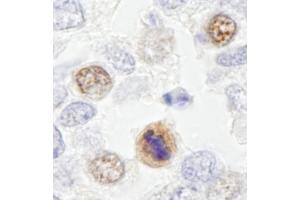 Immunohistochemistry (IHC) image for anti-Centromere Protein F (CENPF) (AA 2350-2400) antibody (ABIN7448938) (CENPF anticorps  (AA 2350-2400))