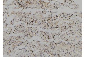 ABIN6257733 and ABIN6273708 at 1/100 staining Human lung tissue by IHC-P. (SYCP2 anticorps  (Internal Region))