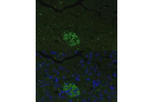 Immunofluorescence analysis of mouse pancreas cells using FB antibody (ABIN3021390, ABIN3021391, ABIN3021392 and ABIN6215001) at dilution of 1:100. (FAM3B anticorps  (AA 30-235))