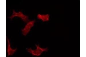 ABIN6266521 staining LOVO by IF/ICC.