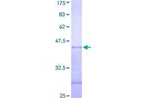 Image no. 1 for Serine/threonine-Protein Kinase PRP4 Homolog (PRPF4B) (AA 581-680) protein (GST tag) (ABIN1316398)