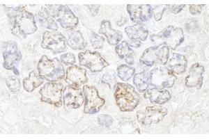 Immunohistochemistry (IHC) image for anti-Nucleoporin 50kDa (NUP50) (AA 418-468) antibody (ABIN7448703) (NUP50 anticorps  (AA 418-468))