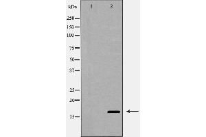 Western blot analysis of Interleukin 4 expression in MCF-7 cells,The lane on the left is treated with the antigen-specific peptide. (IL-4 anticorps  (Internal Region))