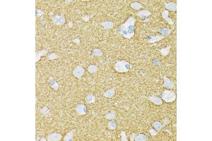 Immunohistochemistry of paraffin-embedded human brain using STXBP1 Rabbit mAb (ABIN7270689) at dilution of 1:100 (40x lens).