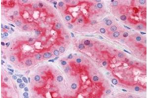 Human Kidney: Formalin-Fixed, Paraffin-Embedded (FFPE)