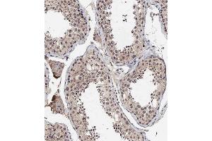 Immunohistochemical analysis of A on paraffin-embedded Human testis tissue. (BRD9 anticorps  (N-Term))