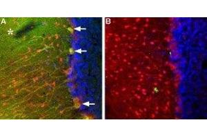 Expression of TRPC3 in rat cerebellum - Immunohistochemical staining of TRPC3 in rat cerebellum using Anti-TRPC3 Antibody (ABIN7043820, ABIN7043966 and ABIN7043967).