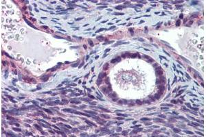 Anti-ELOVL5 antibody  ABIN960767 IHC staining of human ovary.