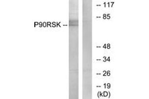 Western blot analysis of extracts from NIH-3T3 cells, treated with PMA 125ng/ml 30', using p90 RSK (Ab-573) Antibody. (RPS6KA3 anticorps  (AA 539-588))
