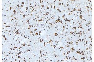 ABIN6277803 at 1/100 staining Mouse brain tissue by IHC-P.