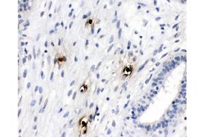 IHC analysis of Mast Cell Tryptase using anti-Mast Cell Tryptase antibody (ABIN4886754).