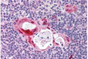 Human Thymus (formalin-fixed, paraffin-embedded) stained with TLR6 antibody ABIN214000 at 5 ug/ml followed by biotinylated goat anti-rabbit IgG secondary antibody ABIN481713, alkaline phosphatase-streptavidin and chromogen. (TLR6 anticorps  (N-Term))