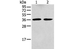 Western blot analysis of Mouse brain tissue and Human fetal brain tissue using GNAI2 Polyclonal Antibody at dilution of 1:400 (GNAI2 anticorps)