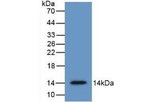 Detection of Recombinant SFRP4, Human using Monoclonal Antibody to Secreted Frizzled Related Protein 4 (SFRP4)