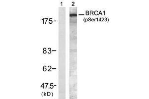 Image no. 1 for anti-Breast Cancer 1 (BRCA1) (pSer1423) antibody (ABIN273605) (BRCA1 anticorps  (pSer1423))