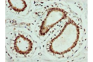 anti-Erythropoietin Receptor (EPOR) (AA 320-506) antibody