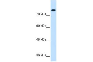WB Suggested Anti-SNF1LK Antibody Titration:  1. (SIK1 anticorps  (N-Term))