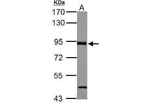 WB Image ABR antibody [C3], C-term detects ABR protein by Western blot analysis. (ABR anticorps  (C-Term))