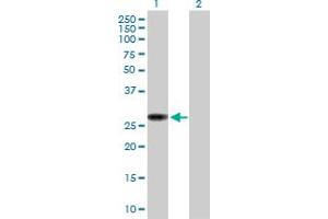 Western Blot analysis of NAT9 expression in transfected 293T cell line by NAT9 MaxPab polyclonal antibody. (NAT9 anticorps  (AA 1-207))
