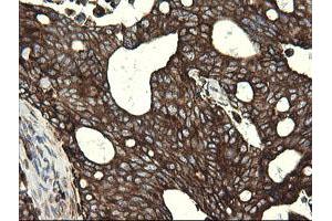 Image no. 4 for anti-Pogo Transposable Element with KRAB Domain (POGK) antibody (ABIN1500328)