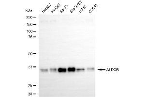 anti-Aldolase B, Fructose-Bisphosphate (ALDOB) antibody