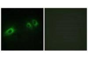 Immunofluorescence analysis of HeLa cells, using LAMB1 antibody.