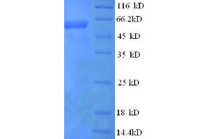 Protein expressed in E.
