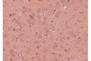 Immunohistochemistry of GOLPH2 in rat brain tissue with GOLPH2 antibody at 2.