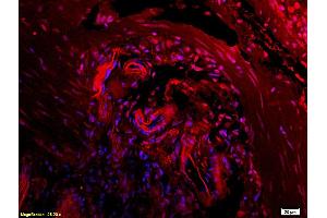 L1 rat kidney lysates L2 rat brain lysates probed with Anti CTHRC1 Polyclonal Antibody, Unconjugated (ABIN759281) at 1:200 in 4 °C. (CTHRC1 anticorps  (AA 31-130))