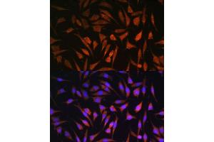 Immunofluorescence analysis of L929 cells using RALGDS antibody (ABIN7269838) at dilution of 1:100.